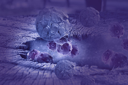 人体癌细胞的数字图示医疗治疗皮肤细菌药品疾病胸部感染科学插图图片