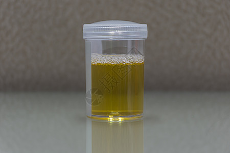 用于实验室检查的尿液保健运动科学塑料身体测试液体小便玻璃化学品图片