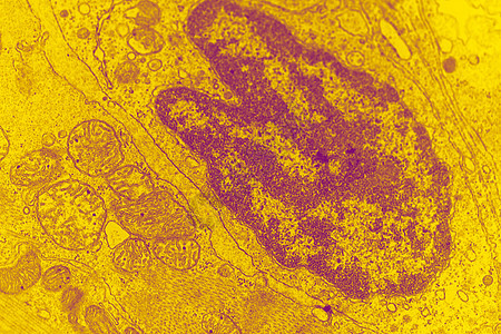 高放大度时细胞核的电子显微图考试细胞宏观药品微生物学金鱼动物显微镜医学科学图片