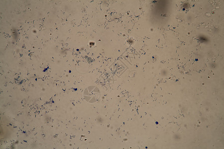 显微镜下的肺结核细菌 400x块茎科学结核瘟疫感染致命背景图片