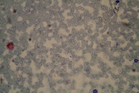 显微镜下红血细胞中的疟疾寄生虫400x筷子热带科学瘟疫疾病诊断感染病菌图片