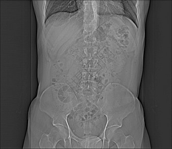 人类腹部人 男人 CT扫描骨盆诊断药品内脏树干肋骨考试脊柱器官x光图片