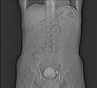 人类腹部人 男人 CT扫描内脏肋骨x光脊柱器官射线骨盆药品树干考试图片
