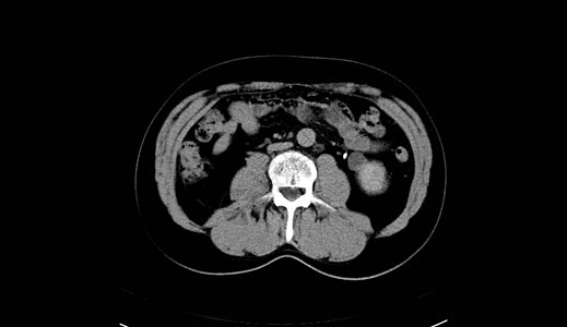 人类腹部人 男人 CT扫描诊断树干脊柱x光器官射线内脏骨盆药品肋骨图片