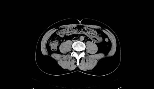 人类腹部人 男人 CT扫描考试药品脊柱器官射线诊断骨盆内脏x光纸巾图片