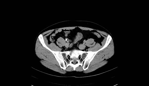 人类腹部人 男人 CT扫描器官诊断x光纸巾肋骨考试脊柱射线药品内脏图片