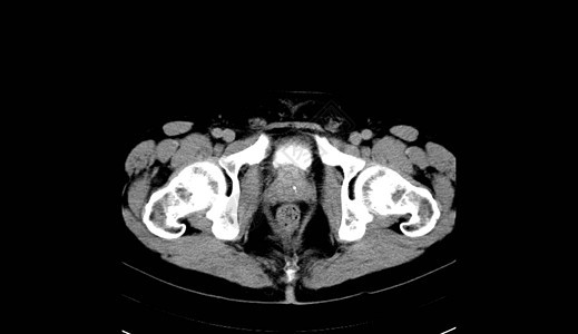人类腹部人 男人 CT扫描考试内脏射线纸巾器官诊断x光脊柱树干骨盆图片