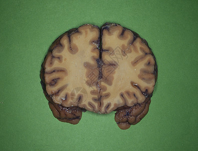 人类大脑被神经切片诊断脊髓逻辑横截面大脑皮层药品小脑器官切面回旋图片