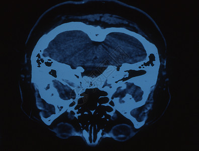 X射线图像中的脑部射线头骨断层小脑科学鼻子x光扫描大脑皮层考试图片