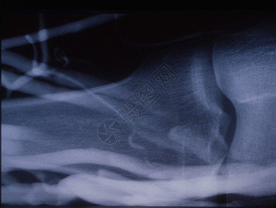 X射线膝关节与静脉背景图片