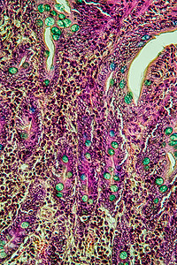 超过100x的小型肠猪组织细胞诊断小肠腺体医生染色三色组织学考试宏观图片