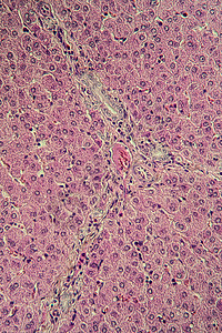 猪肉肝组织切断100x诊断医生组织学器官细胞横截面宏观药品考试科学背景图片