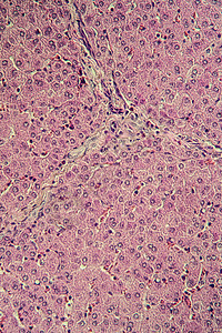 猪肉肝组织切断100x组织学诊断宏观横截面细胞器官考试药品科学医生背景图片