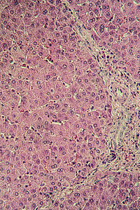 猪肉肝组织切断100x横截面细胞器官药品组织学宏观考试科学诊断医生背景图片