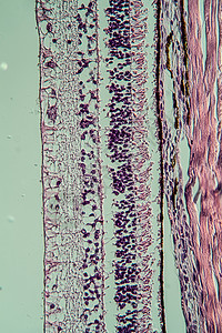 通过视网膜的交叉剖面 100x考试药品医生眼睛组织学细胞组织宏观科学图片