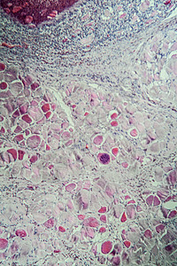 100x 肌肉中的沙子细胞类动物考试组织学疾病组织细胞病理宏观医生科学诊断图片