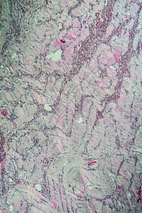 100x 肌肉中的沙子细胞类动物疾病病理细胞科学孢子诊断组织医生药品组织学图片
