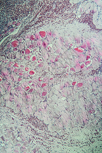 100x 肌肉中的沙子细胞类动物药品组织医生细胞考试科学孢子病理疾病宏观图片