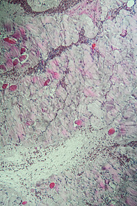 100x 肌肉中的沙子细胞类动物科学宏观药品孢子疾病组织学细胞病理诊断医生图片