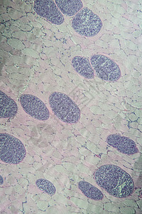 100x 肌肉中的沙子细胞类动物孢子疾病考试医生病理组织细胞组织学宏观药品图片