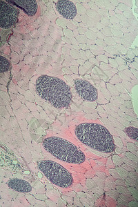 100x 肌肉中的沙子细胞类动物组织学病理医生科学宏观疾病组织孢子药品考试图片