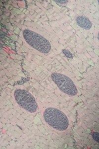 100x 肌肉中的沙子细胞类动物细胞病理组织学孢子医生宏观药品组织疾病科学图片
