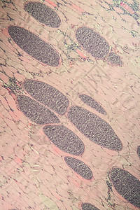 100x 肌肉中的沙子细胞类动物宏观科学病理孢子组织疾病考试医生细胞组织学图片