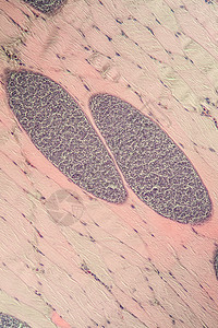 200x 肌肉中的沙子细胞类动物考试组织学孢子组织科学宏观药品疾病医生细胞图片