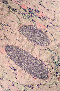 200x 肌肉中的沙子细胞类动物孢子科学考试组织药品医生宏观组织学细胞病理图片