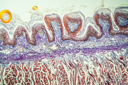 100x以上有味蕾的舌组织宏观药品乳突老兵专用食物诊断组织学科学舌头图片