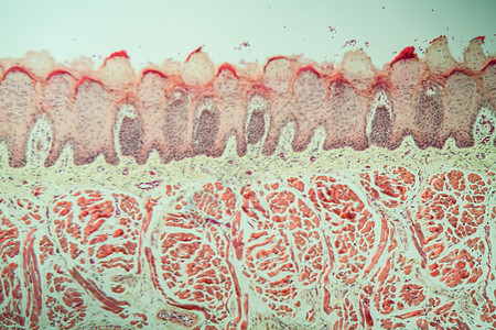 100x以上有味蕾的舌组织舌头专用科学食物宏观乳突诊断医药老兵药品图片