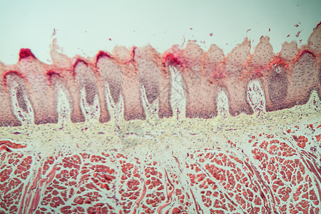 100x以上有味蕾的舌组织食物医药组织学药品老兵乳突科学专用宏观诊断图片