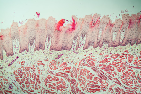 100x以上有味蕾的舌组织舌头专用宏观诊断药品乳突食物科学医药考试背景图片