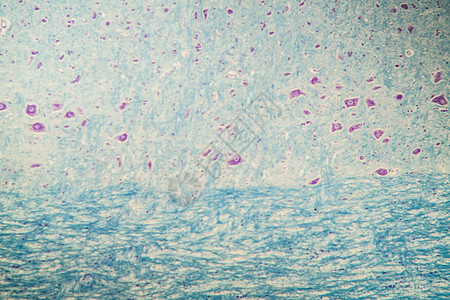 显微镜下神经细胞 100x组织诊断组织学宏观考试科学药品图片