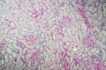 显微镜下的肾脏皮层 100x组织学宏观单位诊断排泄胶囊科学皮质组织考试图片