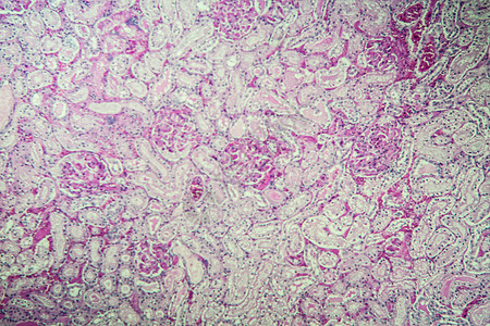 显微镜下的肾脏皮层 100x诊断老鼠康复皮质科学组织学胶囊单位肾小球组织图片