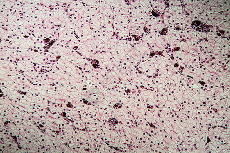 具有肝细胞的Axolot两栖动物 100x组织科学细胞细胞核宏观调查考试诊断康复组织学图片