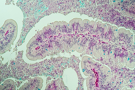 慢性虫菌学昆虫肠道横过逆向100x组织学药品研究消化宏观科学考试蜥蜴腺体分泌图片