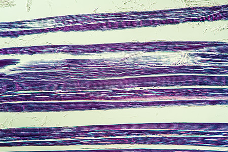 显微镜下断裂的肌肉组织 200x药品组织学宏观考试诊断科学图片