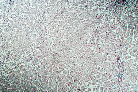 显微镜下病组织肝炎标记100x疾病抗原病理宏观药品组织学科学康复标志物诊断图片