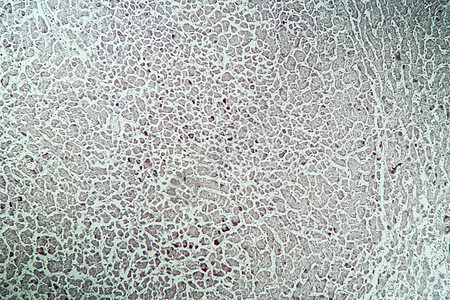 显微镜下病组织肝炎标记100x药品康复病理抗原科学疾病诊断宏观考试组织学图片