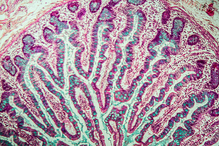 100x 显微镜下小肠胃 有葡萄酒消化组织学药品诊断宏观分泌腺体细胞小肠绒毛图片