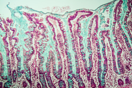 100x 显微镜下小肠胃 有葡萄酒组织组织学诊断分泌绒毛细胞考试药品腺体科学图片