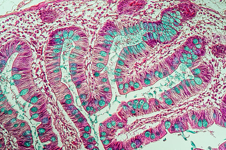 200x 显微镜下有葡萄酒的小肠子宏观消化小肠考试绒毛腺体组织学分泌科学药品图片