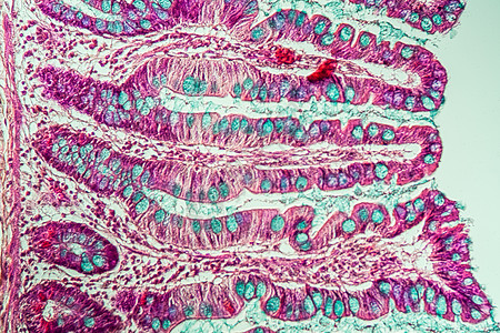 200x 显微镜下有葡萄酒的小肠子绒毛小肠分泌药品诊断细胞考试宏观消化腺体图片