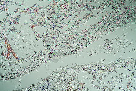 显微镜下病组织氨基菌状体积的肺部蛋白康复考试存款薄片药品病理疾病组织宏观图片