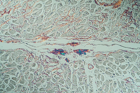 显微镜下病组织氨基亚胺质储存组织学宏观药品考试康复蛋白存款科学医生诊断图片
