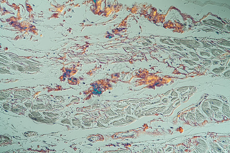 显微镜下病组织氨基亚胺质储存医生薄片药品细胞康复病理组织学疾病宏观考试图片