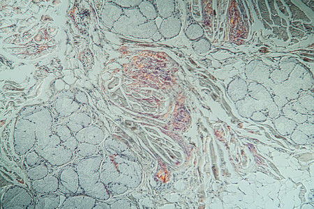 显微镜下病组织氨基状菌积结舌蛋白病理存款康复细胞药品舌头组织学疾病诊断图片