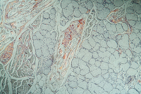 显微镜下病组织氨基状菌积结舌舌头康复科学药品考试医生诊断细胞薄片蛋白图片